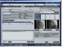 PCI(カテーテル検査レポート)